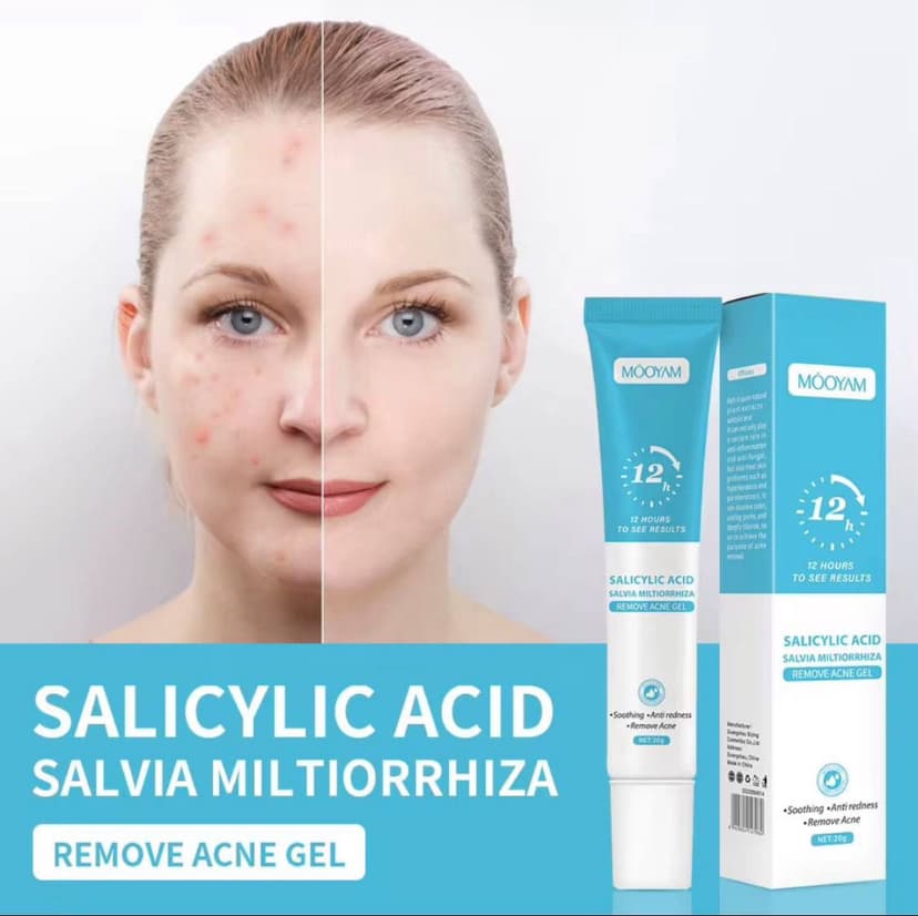 ✨ Gel Anti-Acné à l’Acide Salicylique – Résultats 